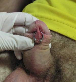 Férfi nemi piercing Budapesten Ár (piercing) Férfi nemi piercing Budapesten ár