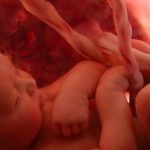 Oxigénhiány a magzat a terhesség alatt tünetek és a kezelés