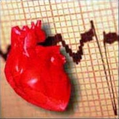 Alacsony szívverés vagy bradycardia (pulzusszám bradycardia alacsony) Alacsony pulzusszám vagy bradycardia