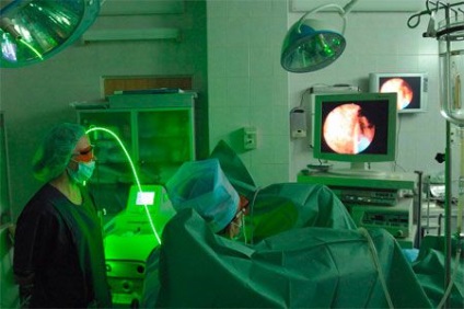 Műtéti eltávolítása a gerinc sérv sebészi beavatkozást igénylő