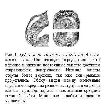 Meghatározása kor a ló (meghatározás) Életkorának meghatározásában egy ló