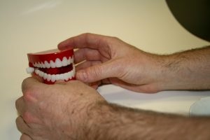 Jellemzők beültetés alsó fogak, meddesk (fogászati implantátumok költség) Jellemzők beültetés alsó fogak, meddesk