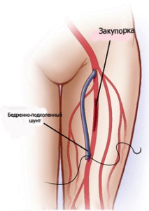 Department of Vascular Surgery Regionális Vascular Center City Klinikai Kórház