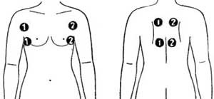 Miostimulyatory Application (alkalmazás) alkalmazás miostimulyatory