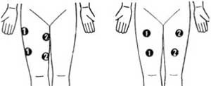 Miostimulyatory Application (alkalmazás) alkalmazás miostimulyatory