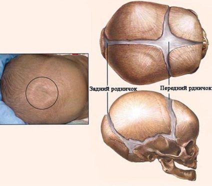 Fontanelle csecsemőknél, ha benőtt - fontanels típusú, normális és kóros!