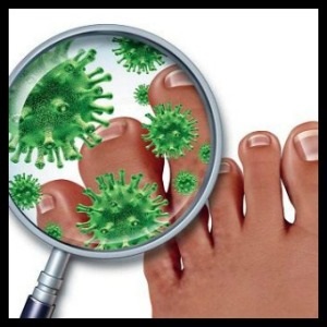 Nail gomba a láb és a kéz okainak, kezelési eljárásokat, a megelőzés