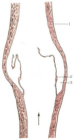 A szerkezet az érfal, Cardioangiology emberi anatómia