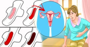 Brown mentesítést a menstruáció alatt, függetlenül attól, hogy veszélyes