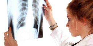 A tuberkulózis tünetei gyermekekben az első tünetek, diagnózis, megelőzés, kezelés