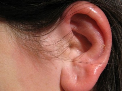 Fülrühösség emberekben a tünetek, jelek és kezelés