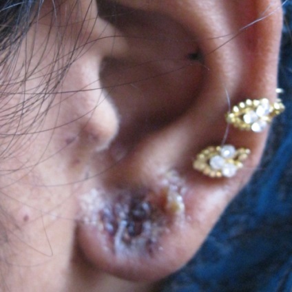 Viszketés a füle okok és a kezelés