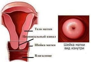 A méhnyak bezárja, ami (a) A méhnyak bezárul, mi ez