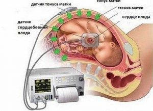 Pulzusszám ütemben HIC keresztül teszteken