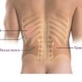 Kétirányú nephroptosis mindkét vese 1. és 2. fok - mi ez