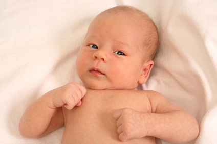 Torticollis újszülöttek - jelek és képek