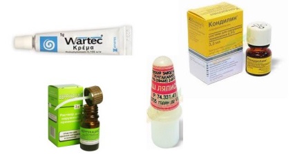 A kenőcsök és egyéb gyógyszerek szemölcsök Áttekintés (szemölcs) A kenőcsök és egyéb gyógyszerek szemölcsök Áttekintés