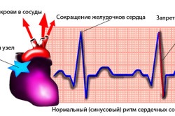 szív-egészségügyi aritmia