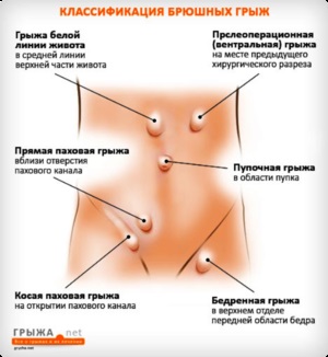 Az okok a fájdalom a jobb oldalon a hátsó és oldalsó, a diagnózis és a betegségek kezelésére