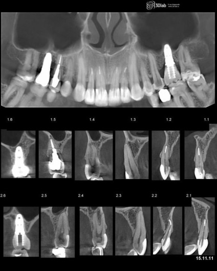 Mi a jobb, MRI vagy ultrahang kontraszt, mint a két módszer két diagnosztikai eljárások és azok