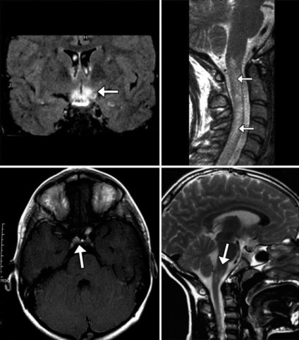 Mi a jobb, MRI vagy ultrahang kontraszt, mint a két módszer két diagnosztikai eljárások és azok