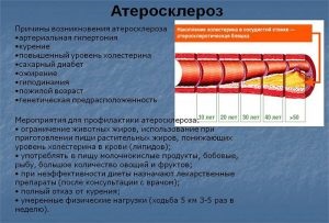 Gyógynövény az érelmeszesedés kezelésére