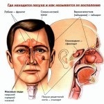 Az orrmelléküreg-gyulladás fotók, jelek és tünetek - Egészségügyi információ