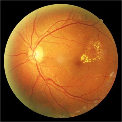 Ahogy fényképezte a szemfenék (támogatás retina kamera) Hogyan lehet fényképezni a szemfenék