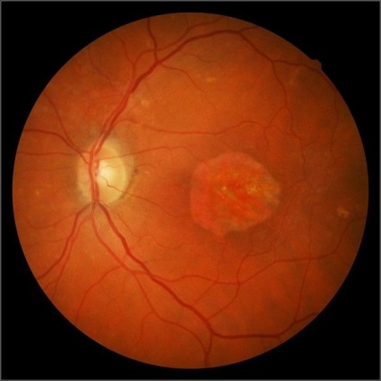 Ahogy fényképezte a szemfenék (támogatás retina kamera) Hogyan lehet fényképezni a szemfenék