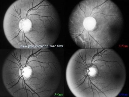 Ahogy fényképezte a szemfenék (támogatás retina kamera) Hogyan lehet fényképezni a szemfenék