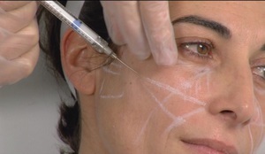 Hogyan és mit lehet megfiatalítani arcbőr technikák és eszközök arcfiatalítás műtét nélkül 60 év után