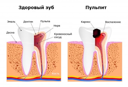 Hogyan kell vigyázni a fogak és az íny