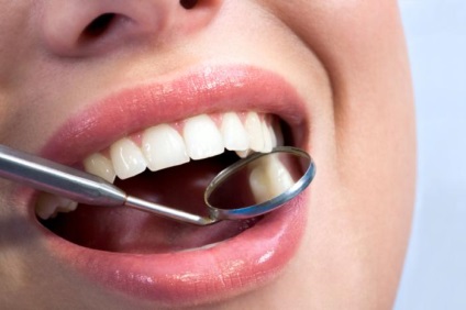 Hogyan kell vigyázni a fogak és az íny