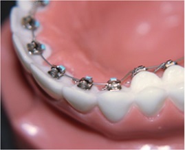 Clinic modern fogszabályozás - az aranymetszés - melles Ufa