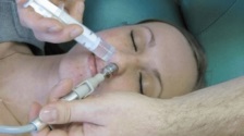 A kezelés a sinusitis sinus katéter YAMIK videó, fénykép, vélemény