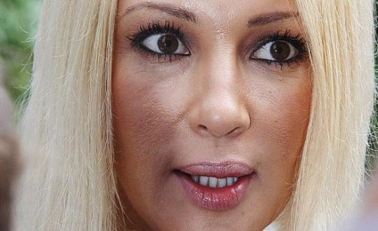 Lera Kudryavtseva képek előtt és után műanyag - 300 (Lera Kudryavtseva után) Lera Kudryavtseva képek előtt és után műanyag - 300