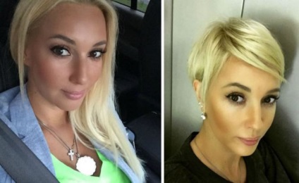 Lera Kudryavtseva képek előtt és után műanyag - 300 (Teller) Lera Kudryavtseva képek előtt és után műanyag - 300