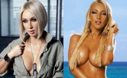 Lera Kudryavtseva képek előtt és után műanyag - 300 (Teller) Lera Kudryavtseva képek előtt és után műanyag - 300