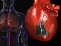 Kábítószer kezelésére sinus bradycardia (szívritmusszabályozó) Kábítószer kezelésére sinus bradycardia