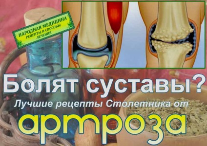 Folk jogorvoslati arthrosis, agave (Folk) Folk jogorvoslati arthrosis, agavé