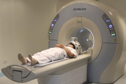 Tekintse MRI az agy -, amely megmutatja