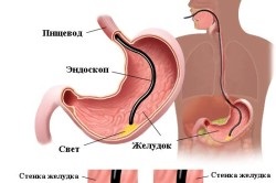 Nyelőcső és emberi gyomor (gyomor) A nyelőcső és a gyomor az ember