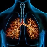 Megelőzése bronchitis, hogyan lehet elkerülni a betegséget, gyógyszerek