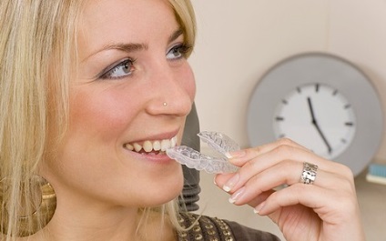 Átlátszó fogszabályozó javallatok időtartama és a kezelés költségeit, előtt és után