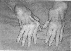Kivonat A klinikai és laboratóriumi diagnózisa reumás arthritisben szenvedő betegek