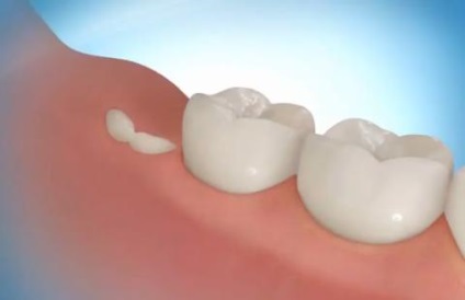 Регенерація зубів - стоматологія майбутнього в Ізраїлі