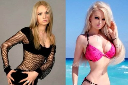 Valeria Lukyanova képek előtt és után plasztikai