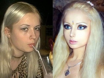 Valeria Lukyanova képek előtt és után plasztikai