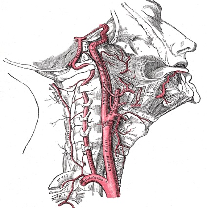 Arteria carotis interna atherosclerosis, trombózis, aneurizma