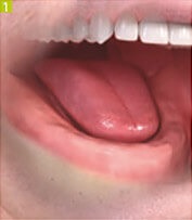 Azt akarom implantátumok fogászati Sumlinski (fog) Azt akarom implantátumok fogászati Sumlinski